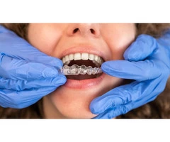 Invisalign treatment in southeast London