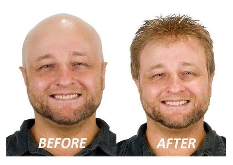 Exploring the World of Hairpieces for Men: Trends and Tips - 2/4