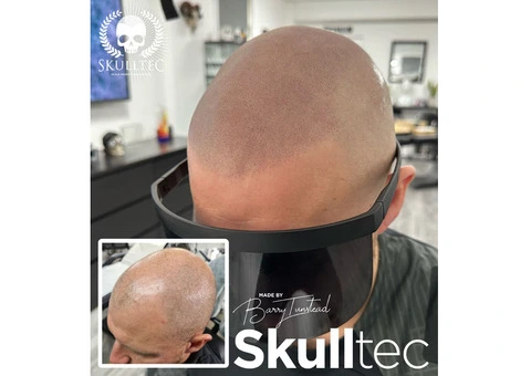 Choosing the Right Scalp Micropigmentation Clinic in London