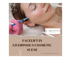 Facelifts in Liverpool's Cosmetic Scene