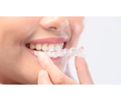 Smile Happily With Invisalign Braces