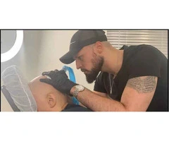 Looking for best scalp micropigmentation uk
