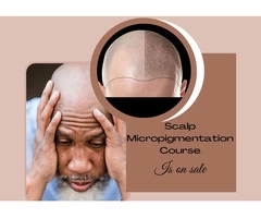 Build Your Career in Scalp Micropigmentation Technician | Scottish Beauty Expert