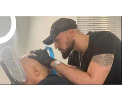 Top Scalp Treatments in Birmingham for Healthy Hair Growth