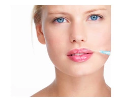 Lip Fillers Nottingham
