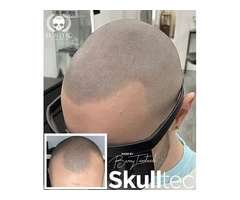 Hair Tattoo For Men in Glasgow
