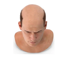 Premier Scalp Treatment in Birmingham