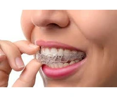 Ditch the Gaffa, Get Grinning! Invisalign® at Harrow Weald Dental Practice