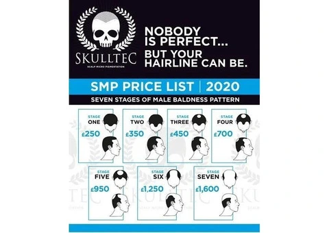 Scalp Micropigmentation Cost UK