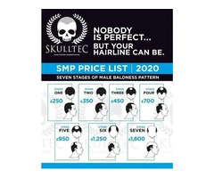 Scalp Micropigmentation Cost UK