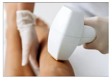 Laser Hair Removal Birmingham