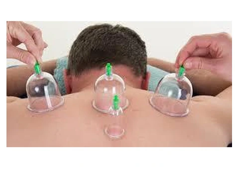 Learn Cupping Therapy Online: Master the Art from Home