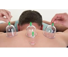 Learn Cupping Therapy Online: Master the Art from Home