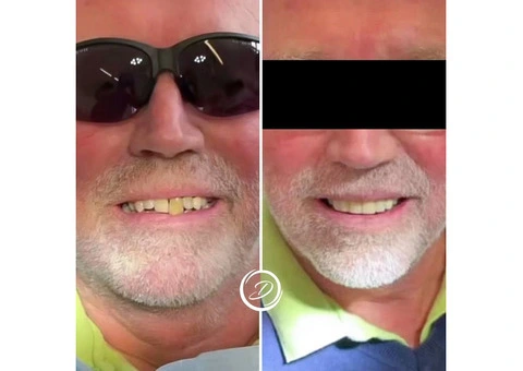 Smile Brighter with Diamond Dental MK - Your Dentists in Milton Keynes - 4/8