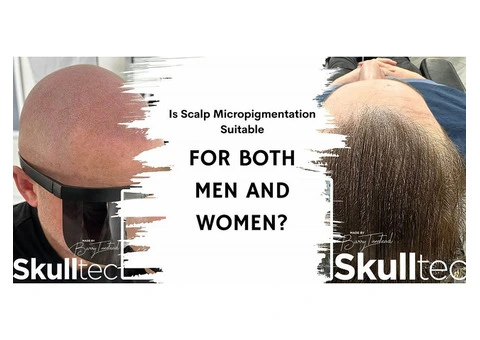 Scalp Micropigmentation For Men and Women