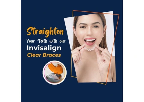 Straighten Your Teeth with our Invisalign Clear Braces