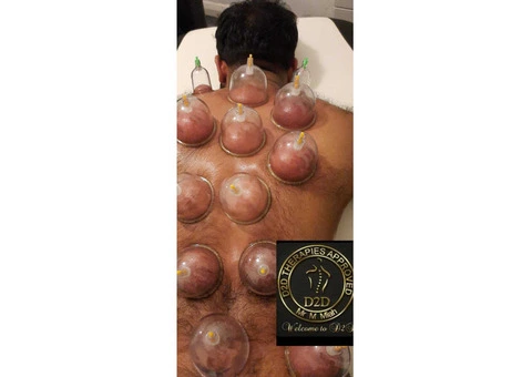 Hijama Training Course in London - 1/3