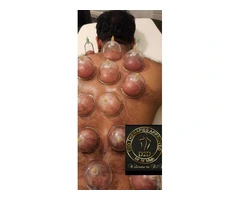 Hijama Training Course in London