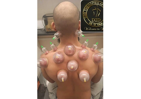 Hijama Training Course in London - 3/3