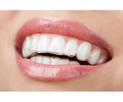 Transform Your Smile with the Best Invisalign Dental Clinic in Bristol!