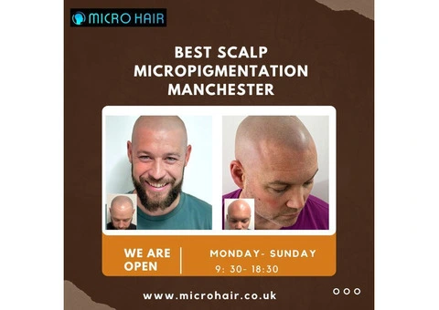 Best scalp micropigmentation Manchester
