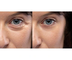 Dr Bela Clinic: Expert Mole Check, Removal, and Dermal Fillers in London
