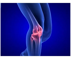 Knee Specialist: Expert Care for Your Knees