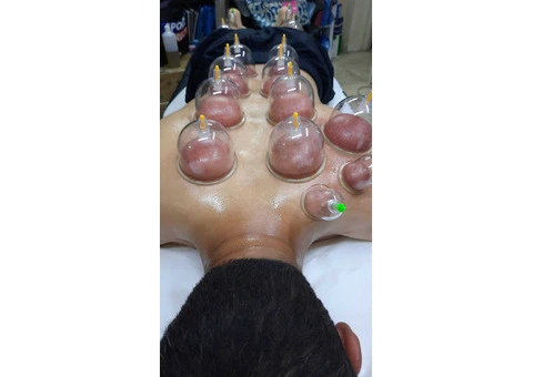 Hijama Training Course in London