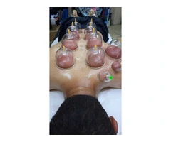 Hijama Training Course in London