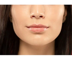 Get Fuller Lips: Trusted Lip Fillers Leeds