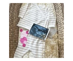 Embrace Parenthood with an Ultrasound Baby Scan in Watford
