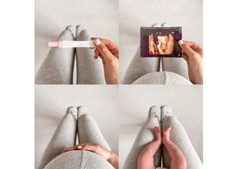 Private 4D Ultrasound Scan Watford – See Your Baby in 4D