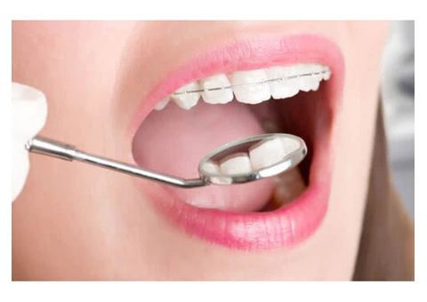 Almost Invisible Teeth Straightening