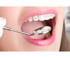 Almost Invisible Teeth Straightening
