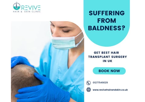 Get Affordable Hair Transplant in UK