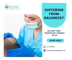 Get Affordable Hair Transplant in UK