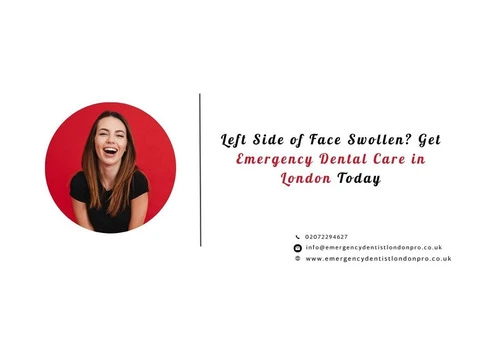 Left Side of Face Swollen? Get Emergency Dental Care in London Today