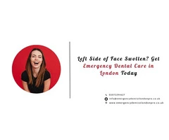 Left Side of Face Swollen? Get Emergency Dental Care in London Today