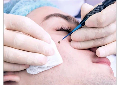 Cosmetic Dermatologist & Skincare Clinic in London | Dr Bela Clinic