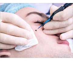 Cosmetic Dermatologist & Skincare Clinic in London | Dr Bela Clinic