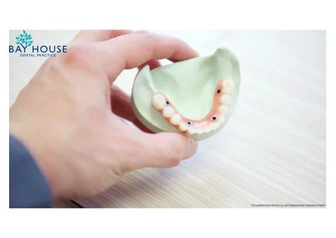 Bay House Dental Practice - 4/8