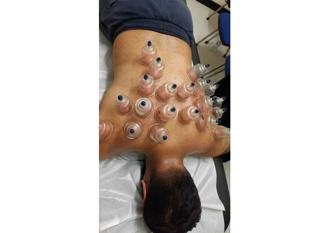 Certified Hijama training course