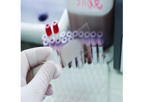 Claret Diagnostics | Coronavirus test clinic - 4/4