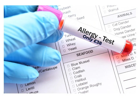 Individual Allergy Testing in London for Only £38