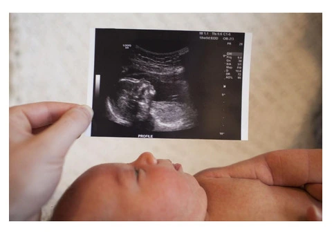 Private 4D Ultrasound Scan in Watford – Book Today!