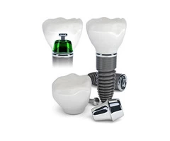 Dental Implants - Excellent Tooth Replacement Method