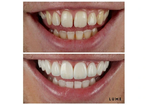 LUME DENTAL - 14/16