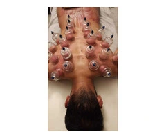 Hijama Training Course in London