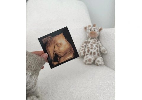 Private Ultrasound Scan Watford - Expert Baby Scanning