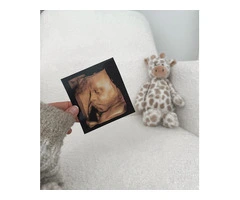 Private Ultrasound Scan Watford - Expert Baby Scanning